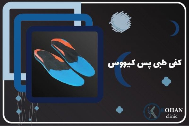 کفی طبی مخصوص قوس زیاد پا