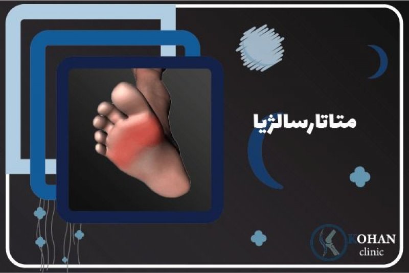 درد سرپنجه پا و انگشتان یا متاتارسالژیا