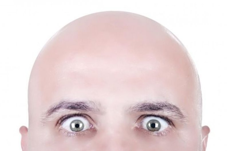   کاشت مو تضمینی با شرایط پرداخت آسان